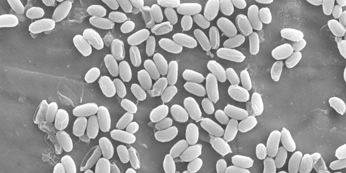 16S rRNA Bacterial Identification | Spore News| Mesa Labs